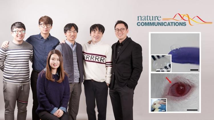 “Smart Contact Lens Sensor” for Diabetic and Glaucoma Diagnosis